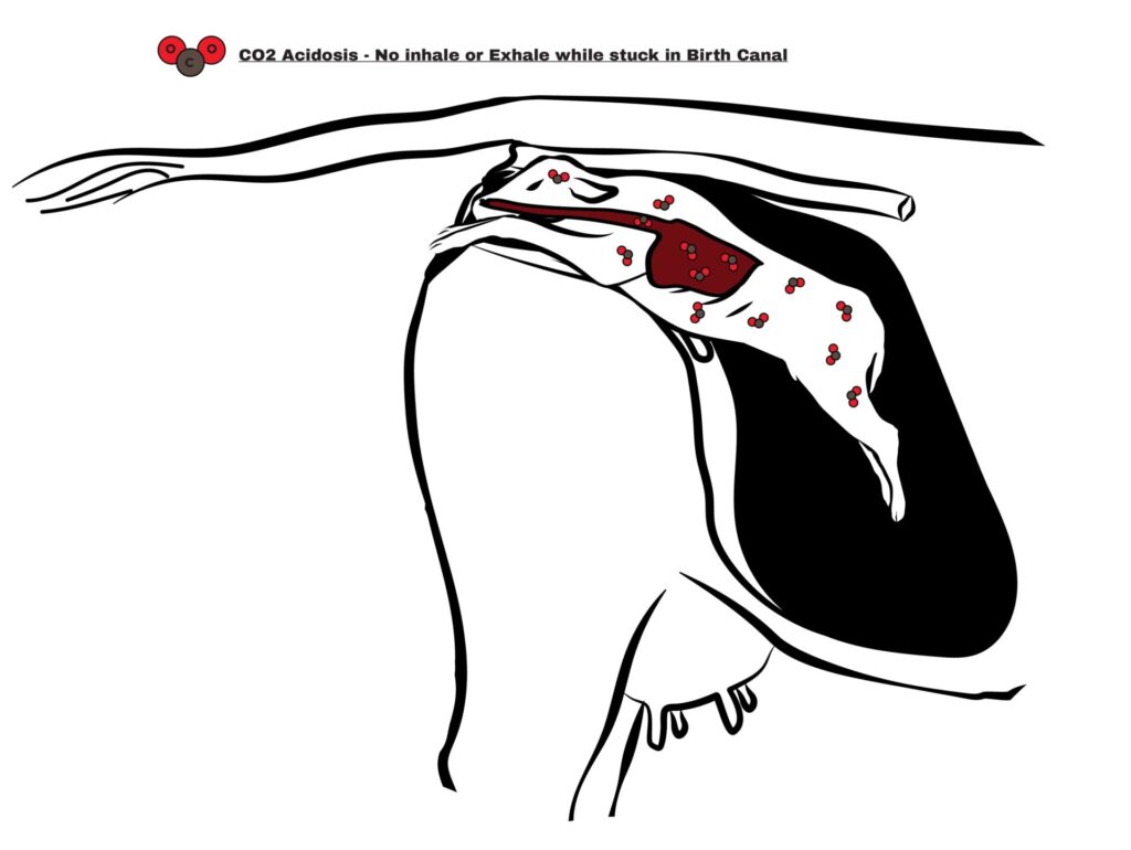 respiratory acidosis can occur when the normal birthing process gets delayed and a calf is unable to clear carbon dioxide from its body